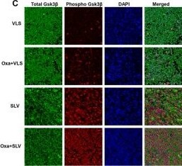 GSK-3 beta Antibody (3D10) - BSA Free
