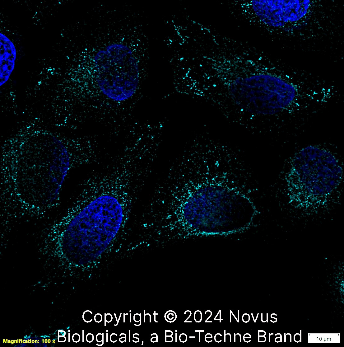Calreticulin Antibody (1G6A7) [Alexa Fluor® 647]