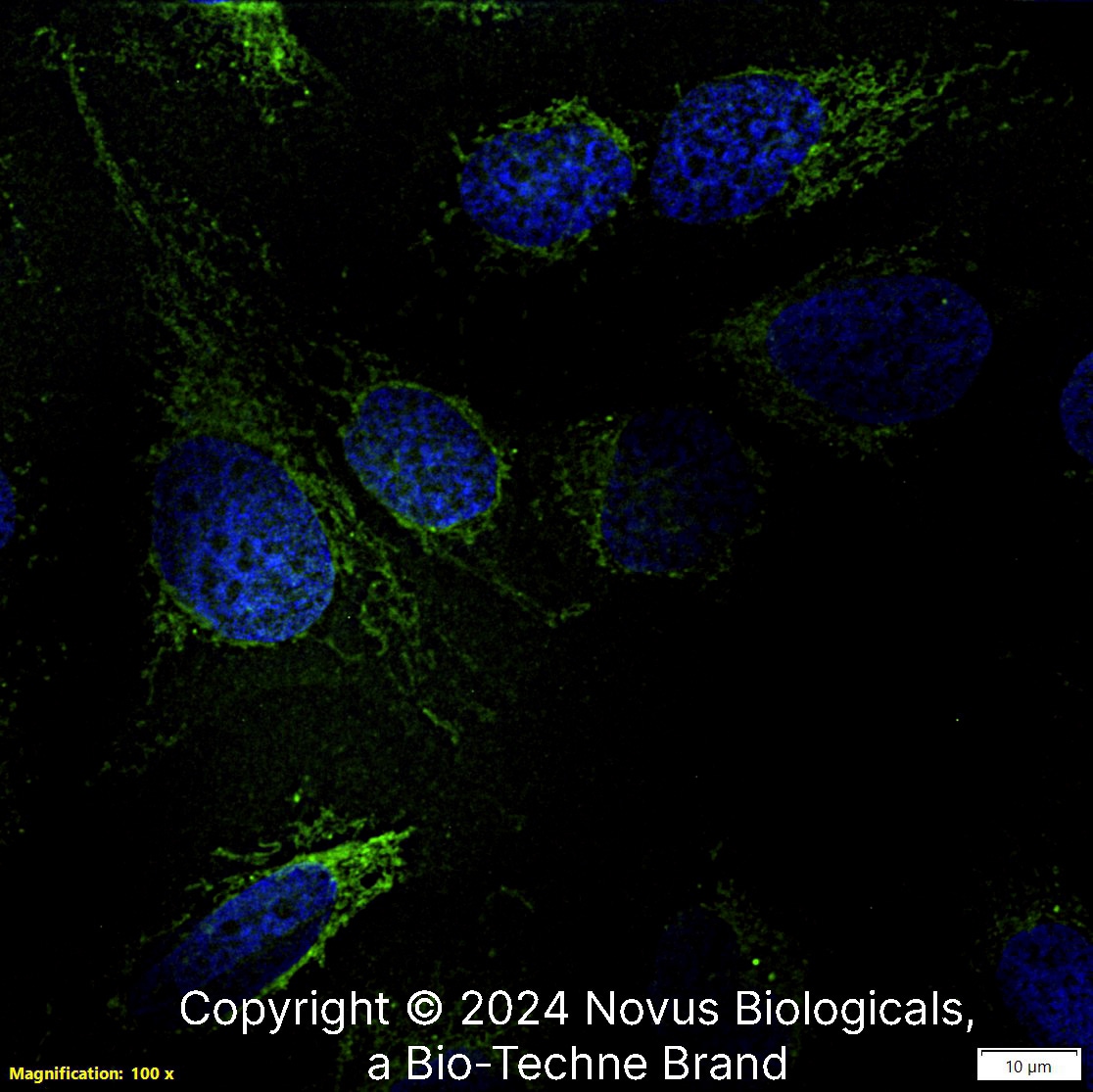 Calreticulin Antibody (1G6A7) [FITC]