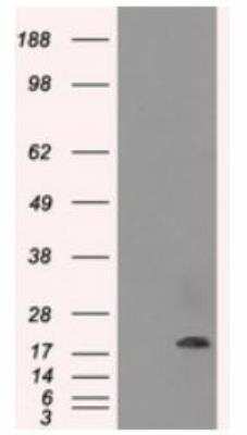 AlphaB Crystallin/CRYAB Antibody (OTI6A9)