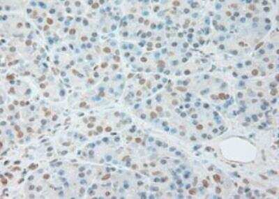 IL-6 Antibody (OTI3G9)