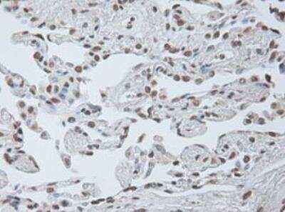 IL-6 Antibody (OTI3G9)