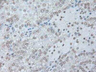 IL-6 Antibody (OTI3G9)