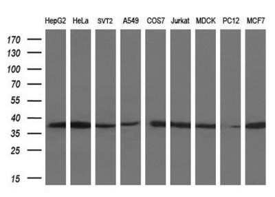 Lactate Dehydrogenase A/LDHA Antibody (OTI2D11)