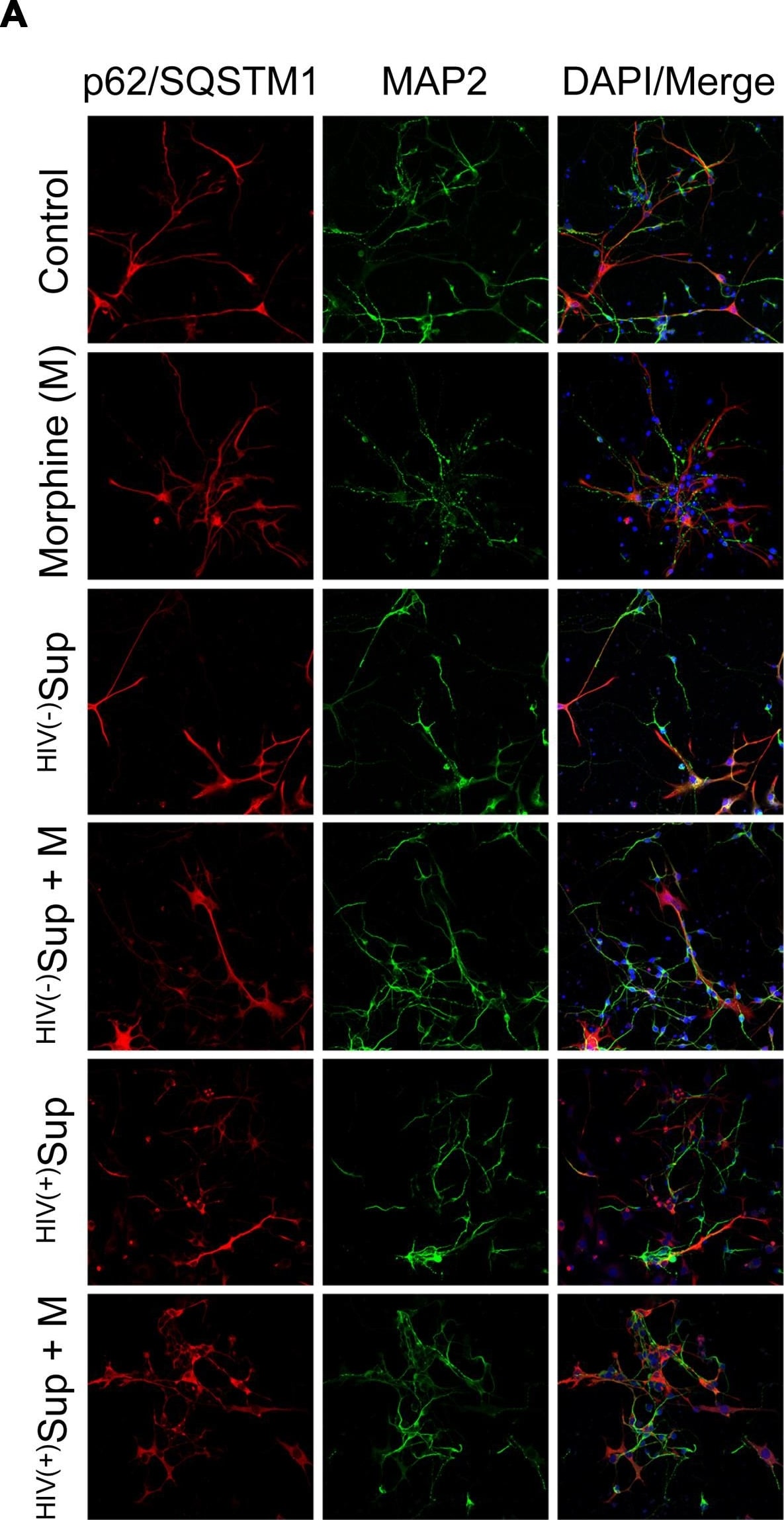 p62/SQSTM1 Antibody - BSA Free