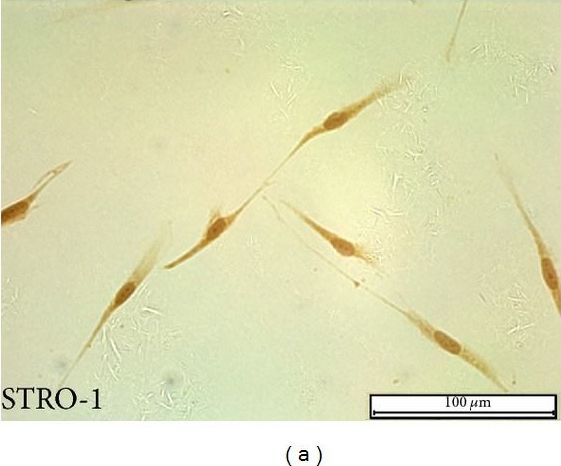 STRO-1 Antibody (STRO-1) - BSA Free