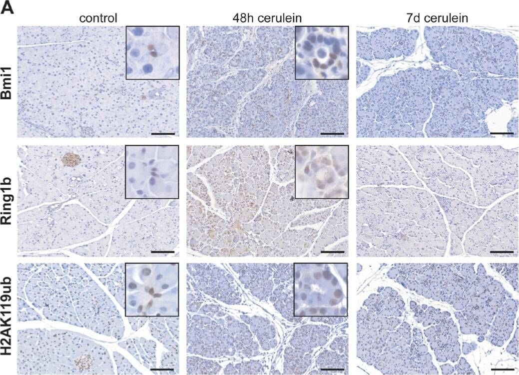 RNF2 Antibody