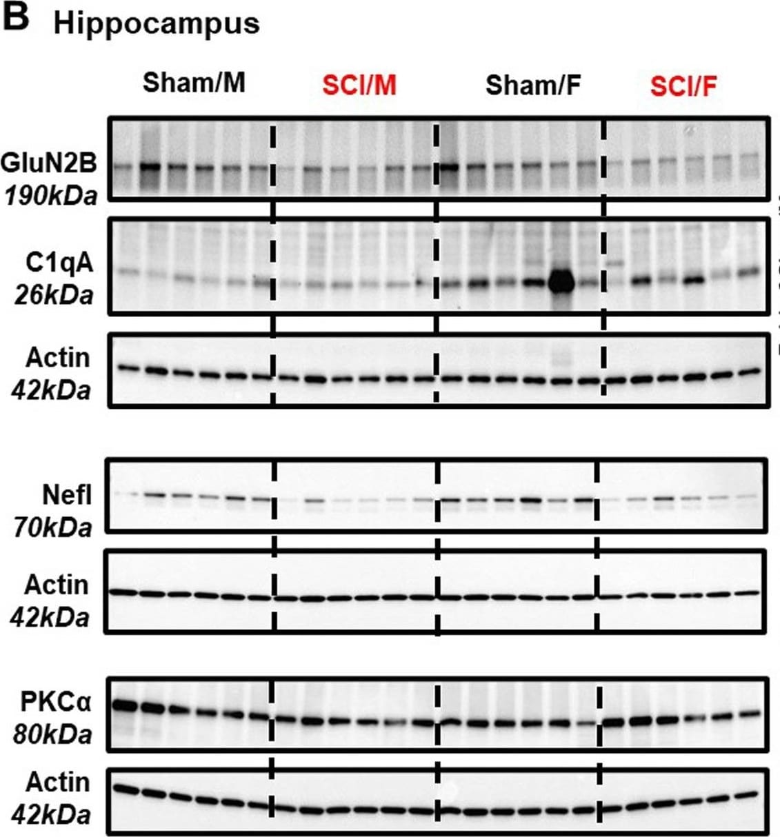 Complement Component C1qA Antibody (JL-1) - Azide Free