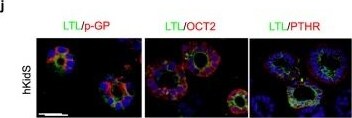 PTH1R/PTHR1 Antibody (4D2) - BSA Free