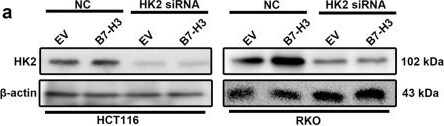 Hexokinase 2 Antibody (3D3) - BSA Free