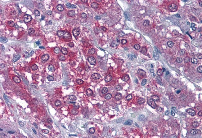 CaM Kinase II alpha Antibody