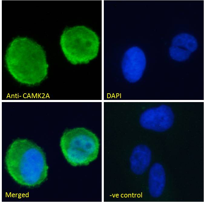 CaM Kinase II alpha Antibody