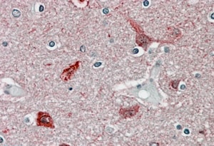 CaM Kinase II alpha Antibody