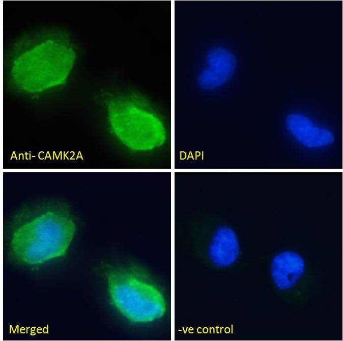 CaM Kinase II alpha Antibody