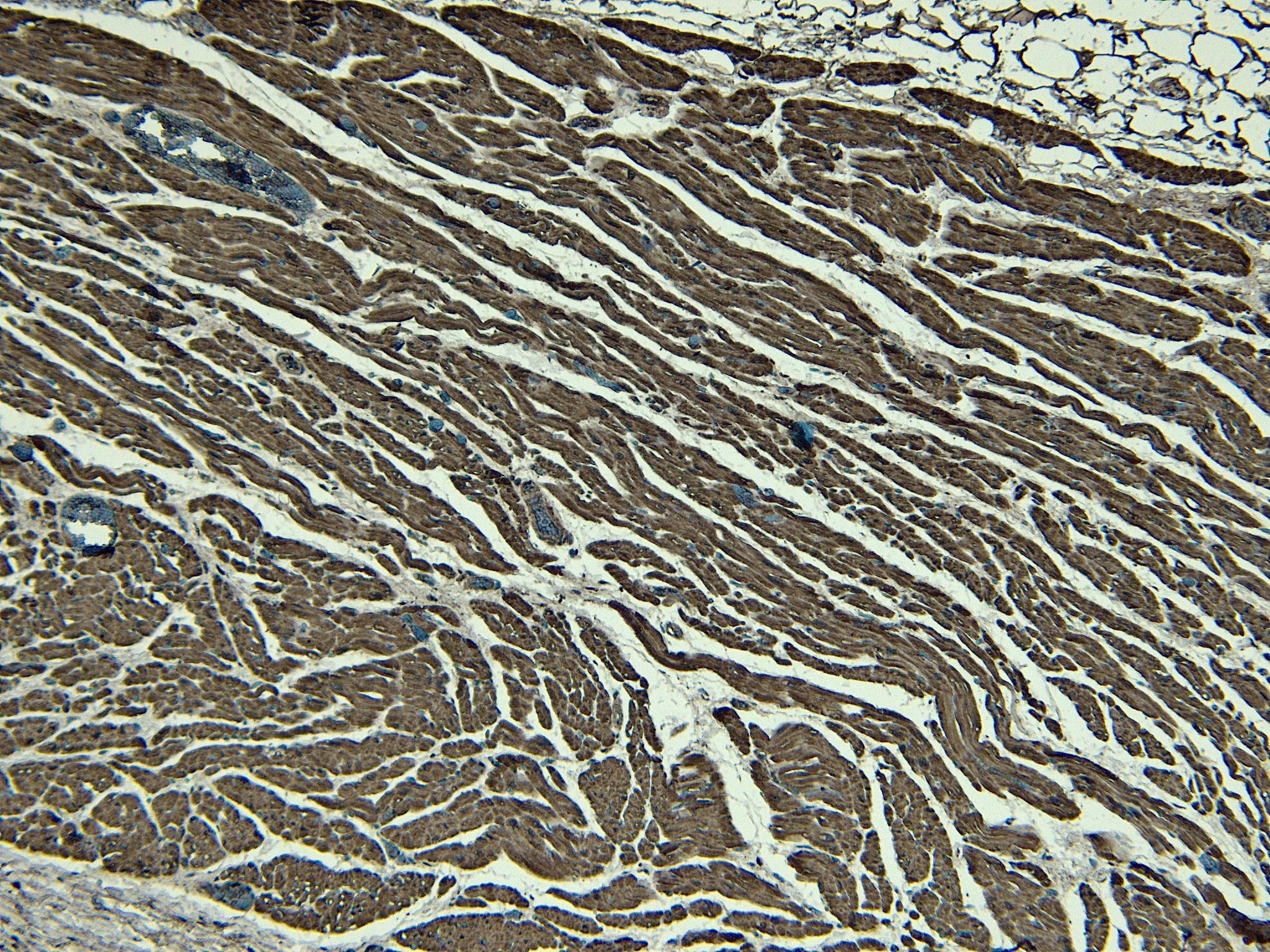 NKX2.5 Antibody