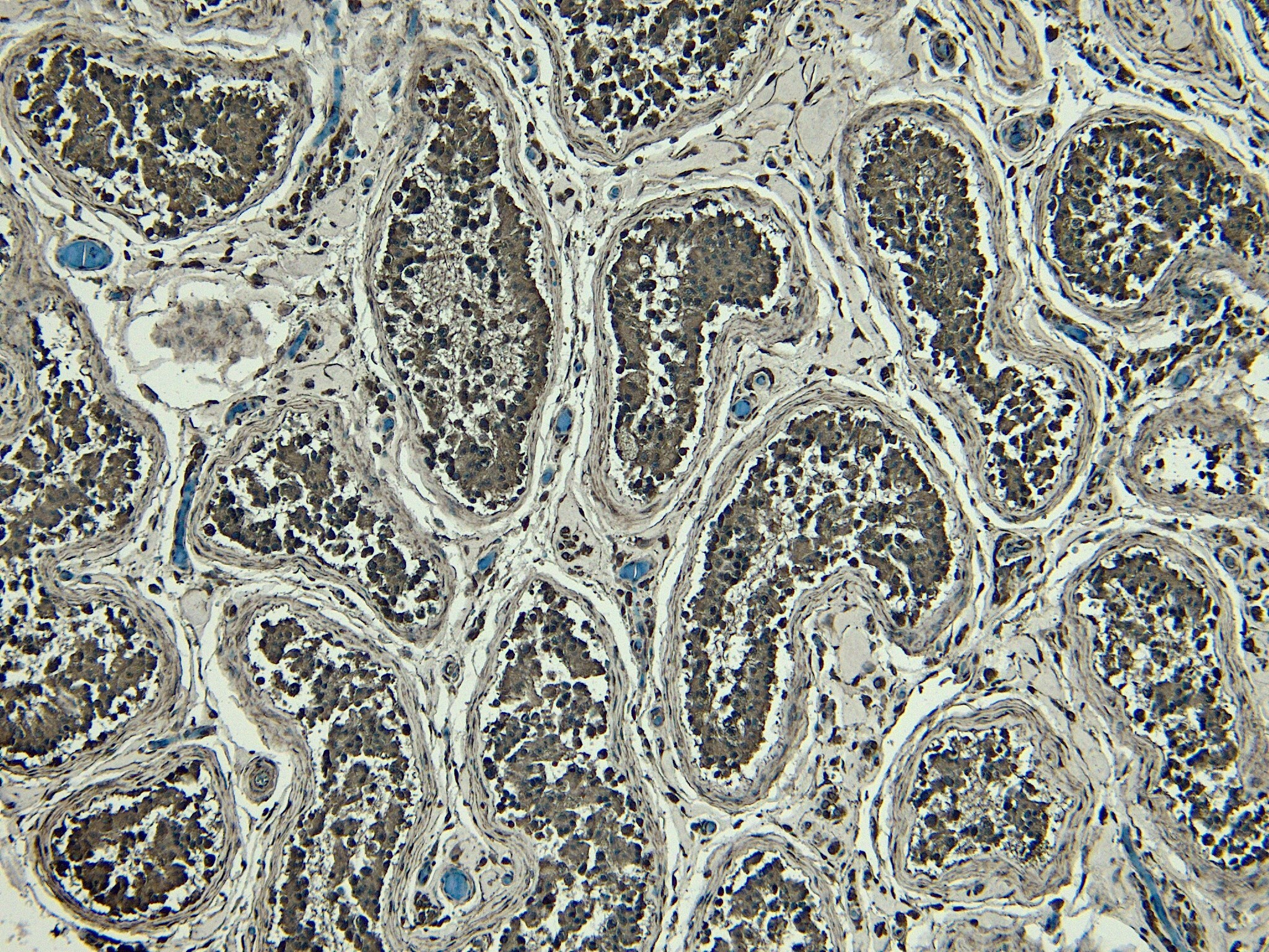 BLIMP1/PRDM1 Antibody