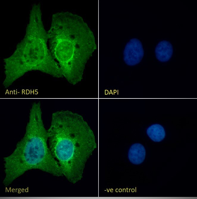 RDH5 Antibody