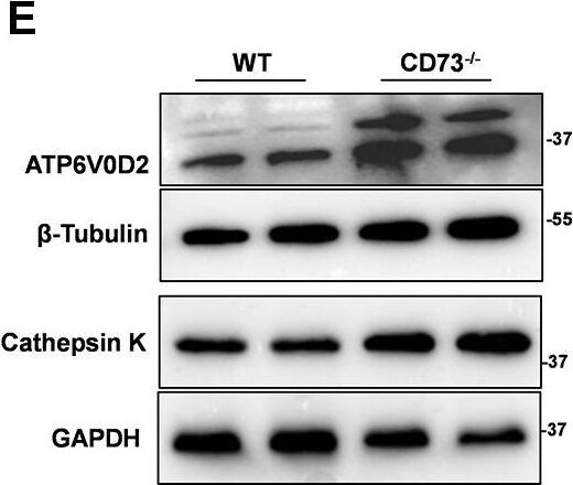 ATP6V0D2 Antibody - BSA Free