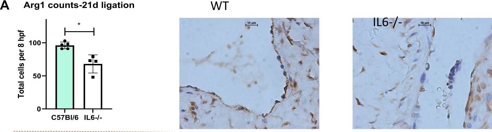 Arginase 1/ARG1/liver Arginase Antibody