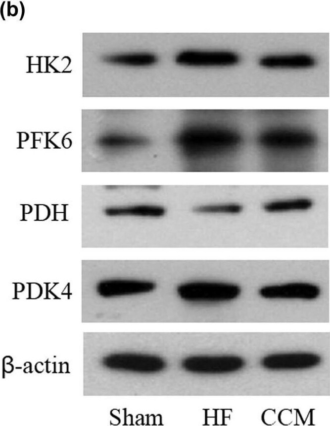 PDK4 Antibody - BSA Free