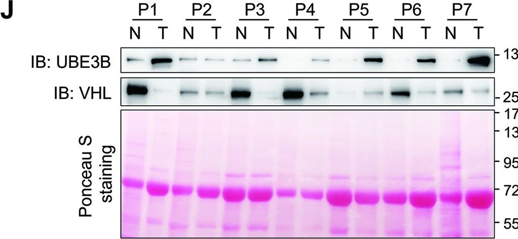 UBE3B Antibody - BSA Free