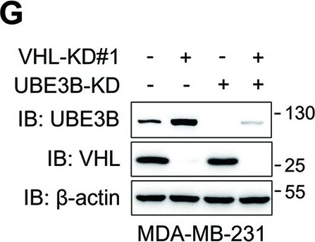 UBE3B Antibody - BSA Free