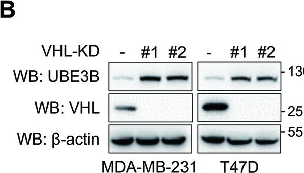 UBE3B Antibody - BSA Free