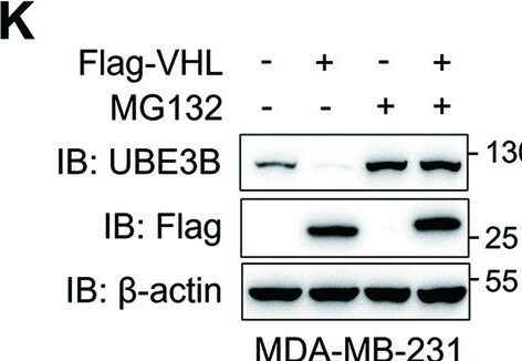 UBE3B Antibody - BSA Free