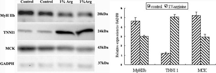 Troponin I Type 1 (slow skeletal) Antibody