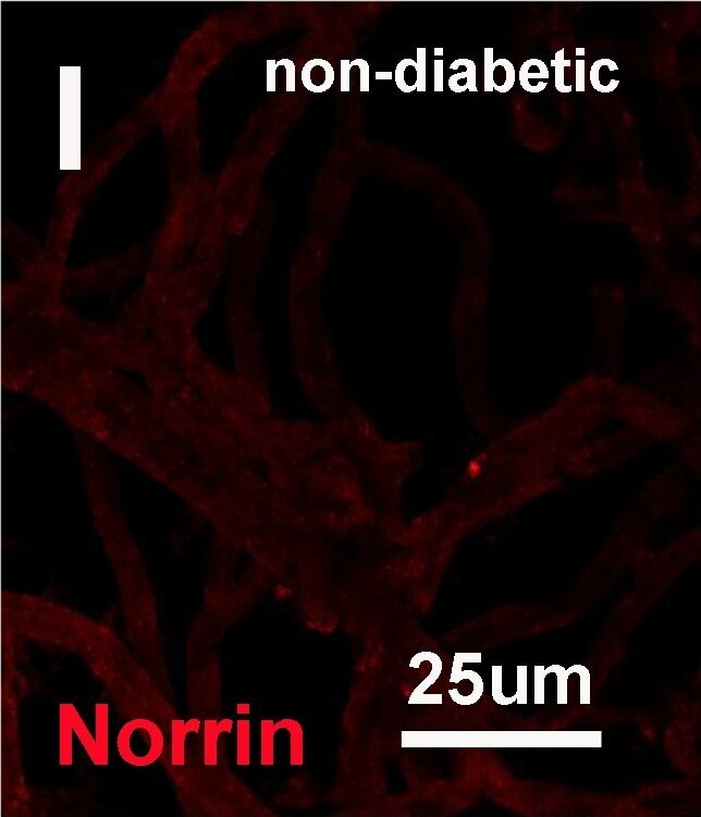 Norrin/NDP Antibody