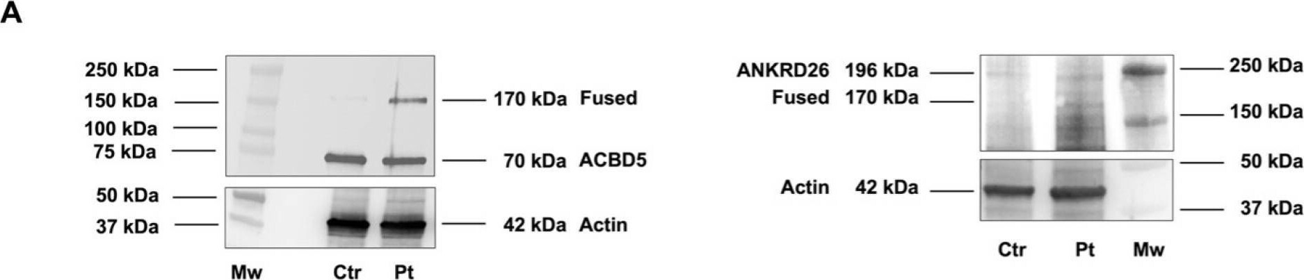 ACBD5 Antibody - BSA Free