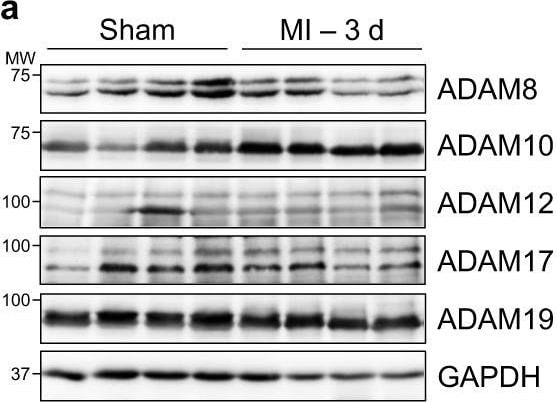 ADAM19 Antibody