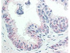 AKT1 [p Ser473] Antibody (17F6.B11)