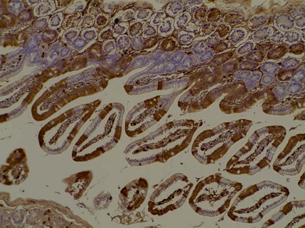 RFP Antibody