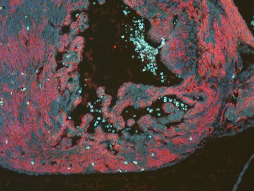 RFP Antibody