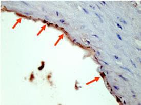 HA Tag Antibody