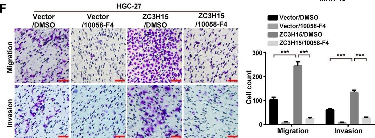 ZC3H15 Antibody - BSA Free