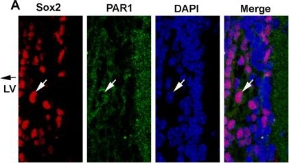 PAR1/Thrombin Receptor Antibody (N2-11)