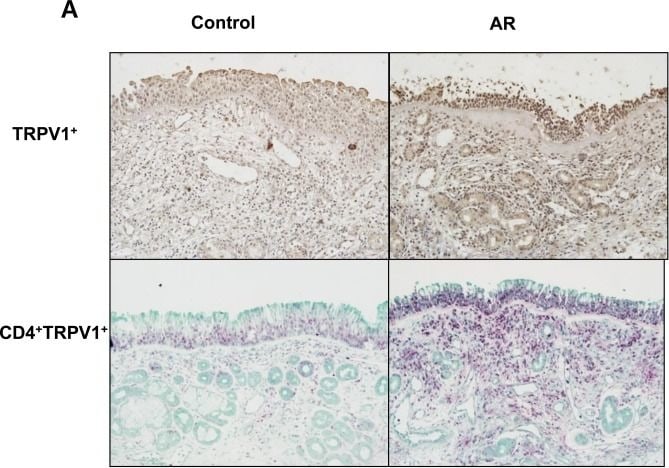 Vanilloid R1/TRPV1 Antibody - BSA Free