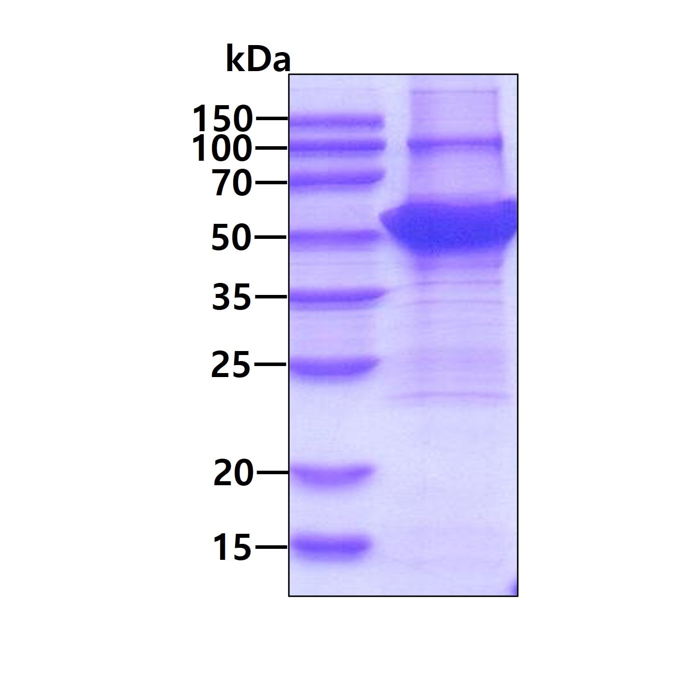 Recombinant Human Cytokeratin 14 His Protein