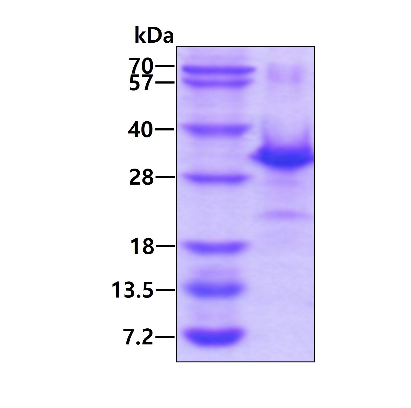 Recombinant Human p27/Kip1 His Protein