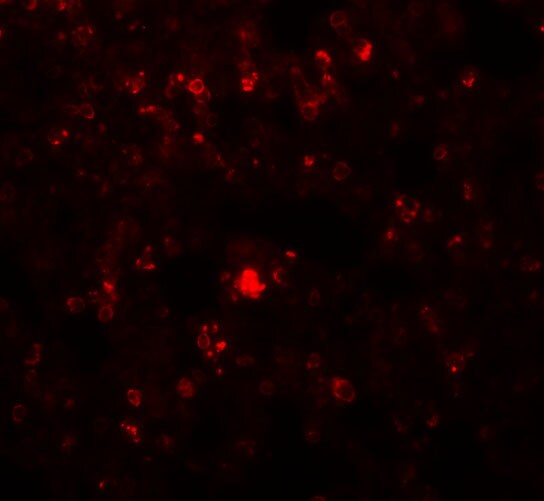 RHBDD2 Antibody - BSA Free
