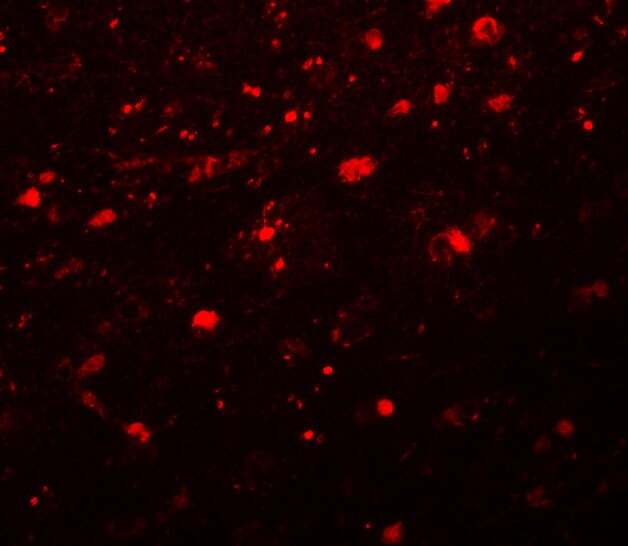 Girdin Antibody - BSA Free