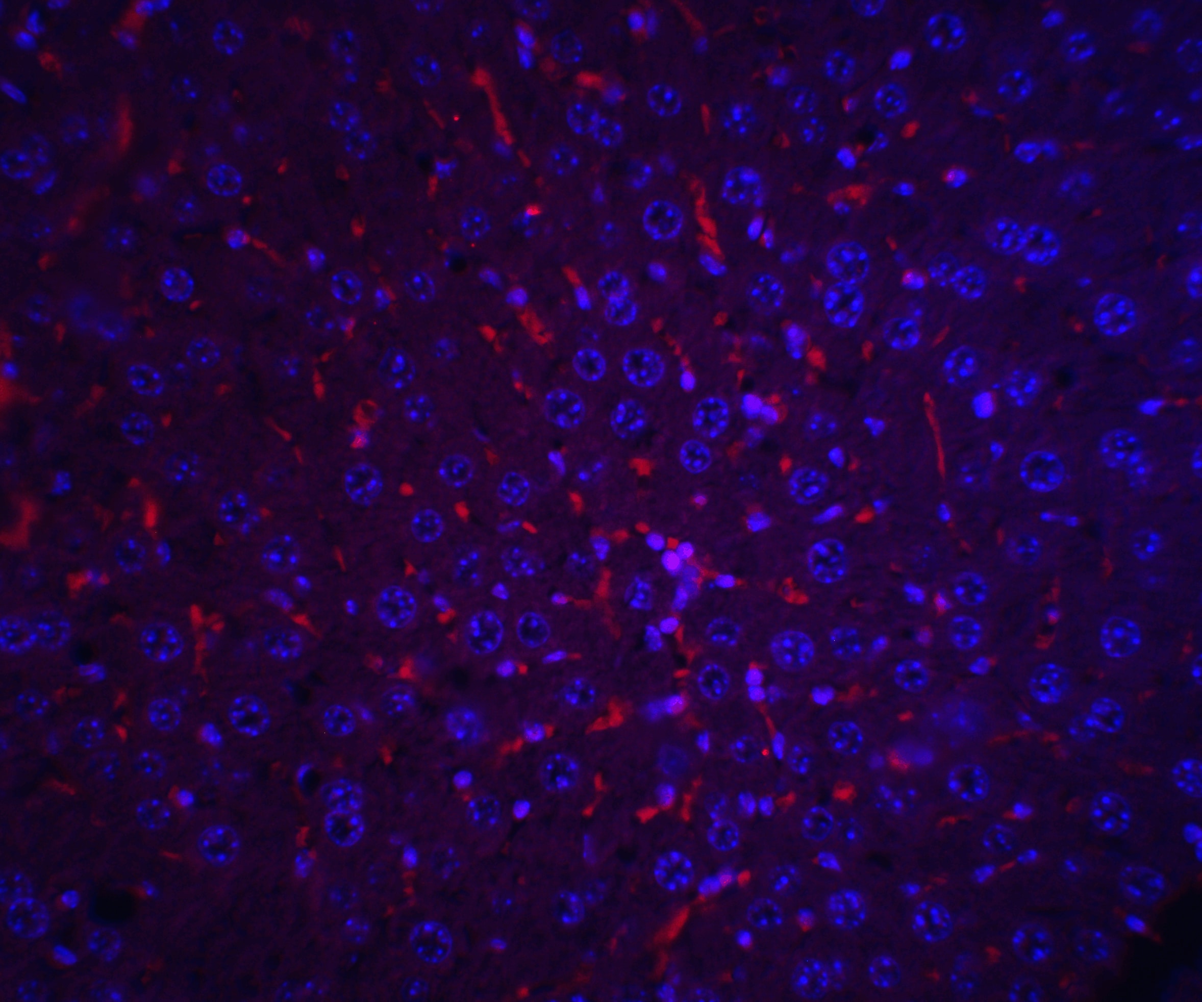 alpha-Fetoprotein/AFP Antibody - BSA Free