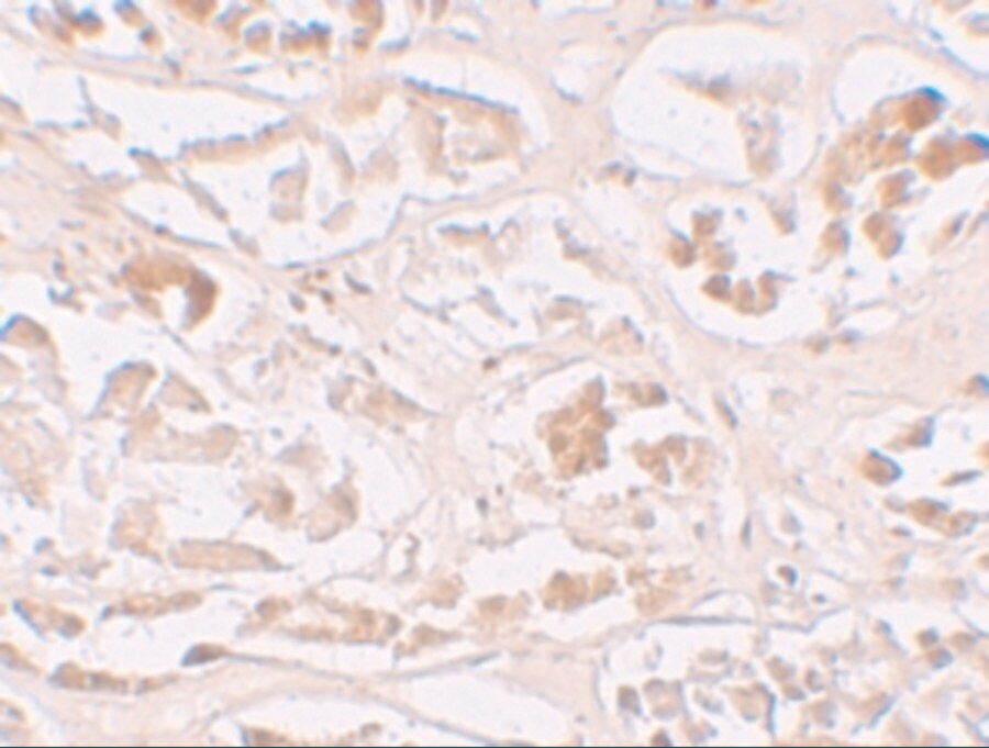 ABH2 Antibody - BSA Free