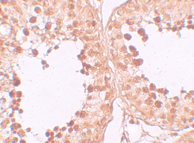 CRISP-2 Antibody - BSA Free