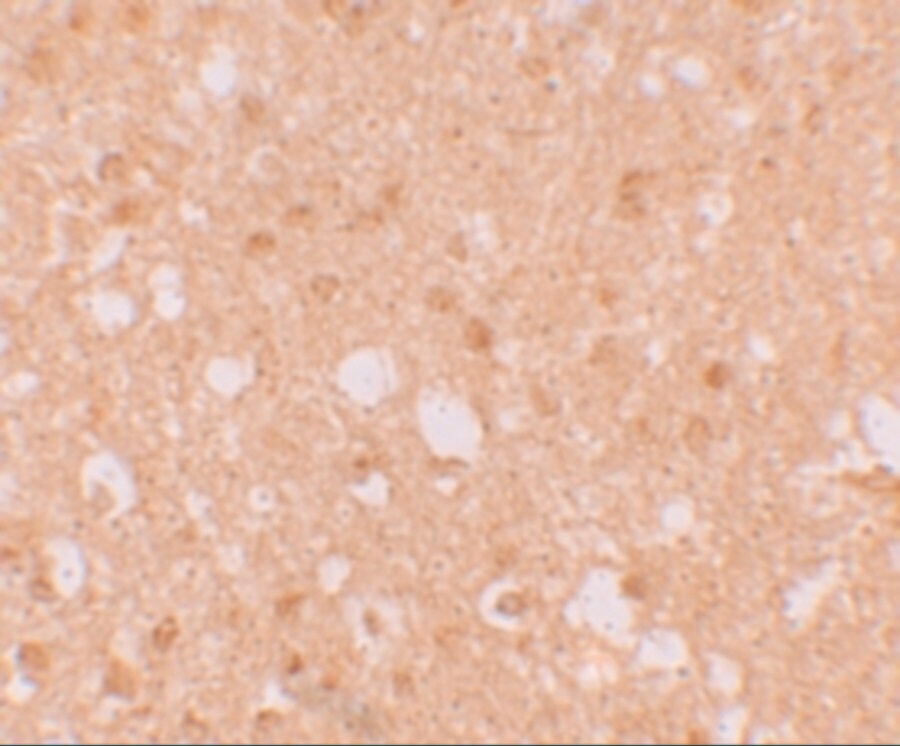 LIN-41/TRIM71 Antibody - BSA Free