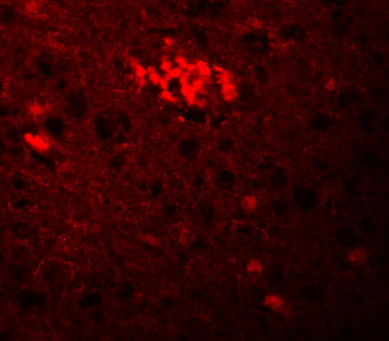 LIN-41/TRIM71 Antibody - BSA Free