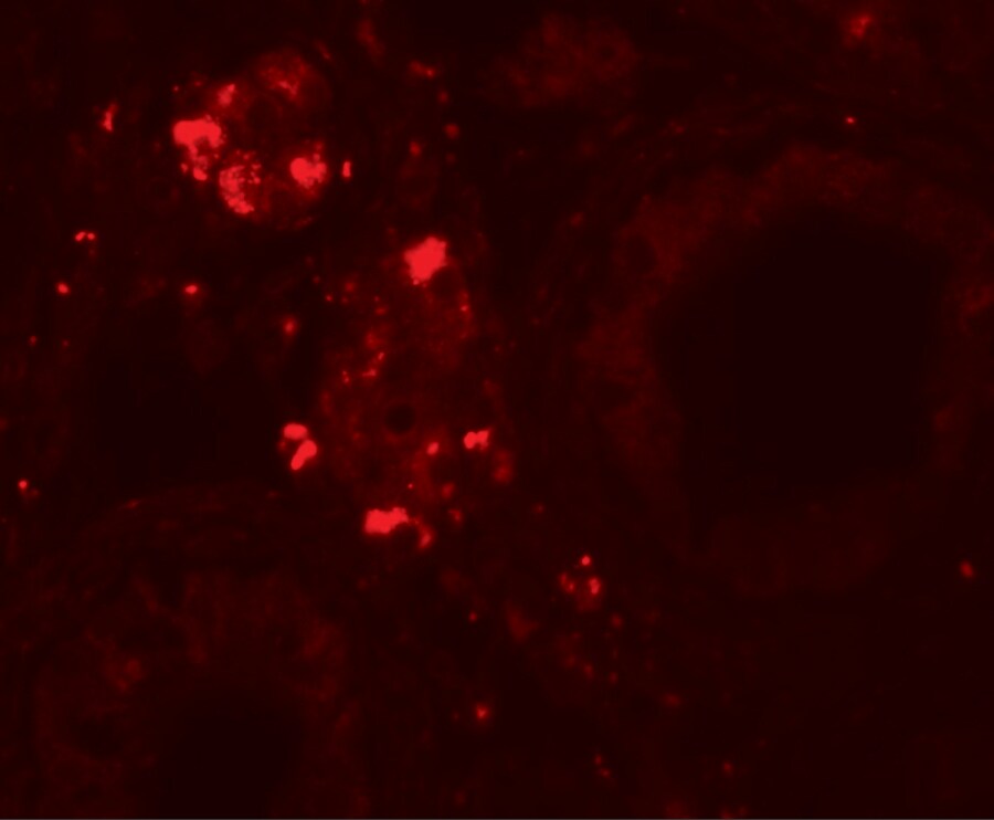 WDR92 Antibody - BSA Free
