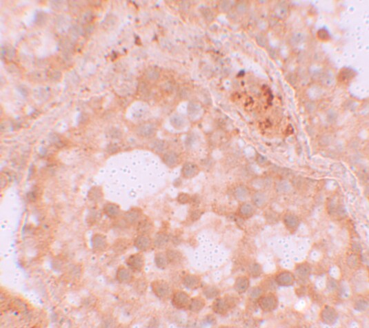 WDR92 Antibody - BSA Free
